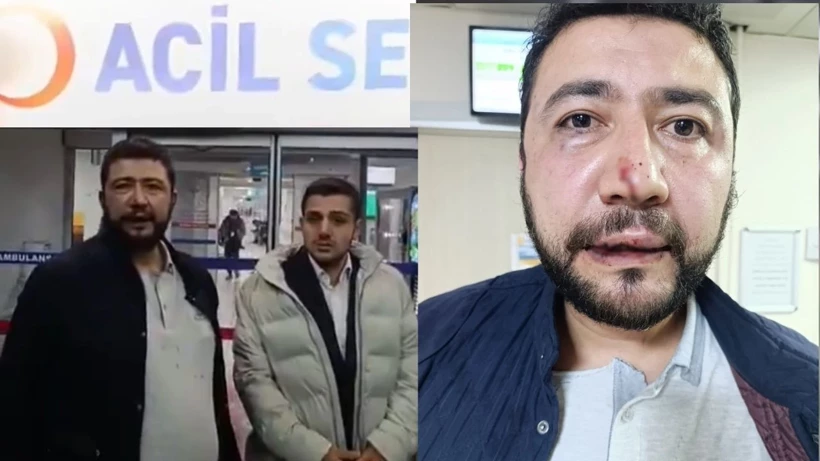 Keçiören Belediyesi'nde Dayak İddiası: Başkan Yardımcısı ve Zabıta Müdürü'ne 'Talimat' Suçlaması