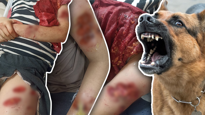 Ankara'da Başıboş Köpek Saldırısı: Çocuk Yaralı!