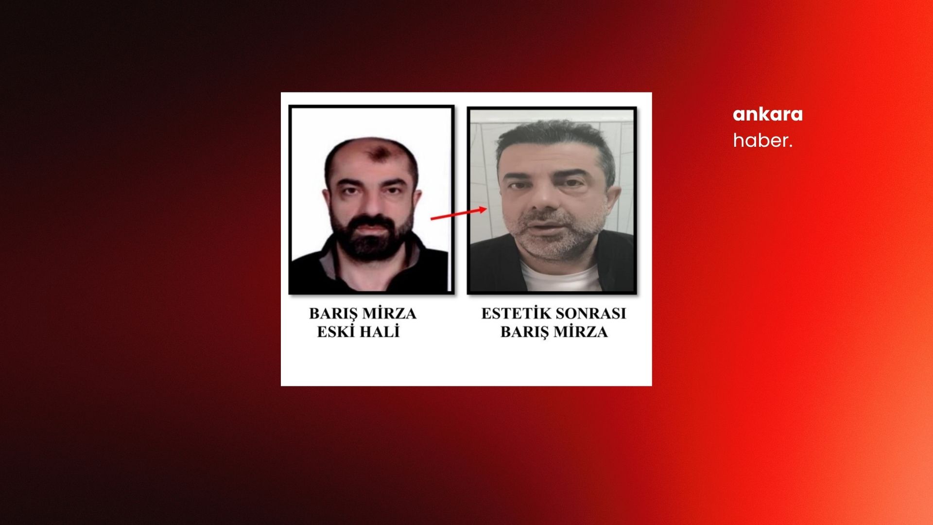 Ankara’da 14 yıllık cinayet dosyasında kritik gelişme: Estetikle yüzünü değiştirip kardeşinin kimliğiyle dönmüş